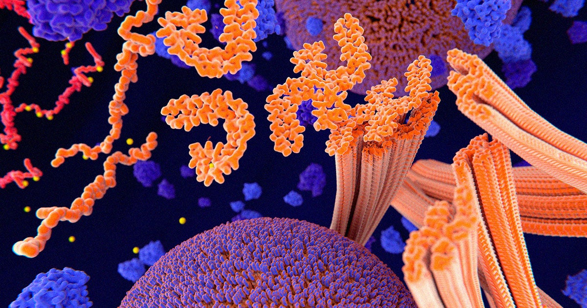 Researchers may have found the molecular-level cause for Alzheimer's by looking deeper into the DNA tangles in the brains of dementia patients. 