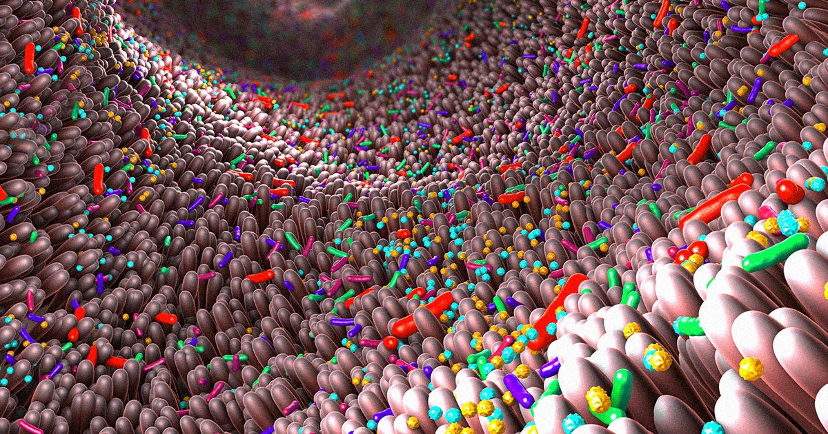 A new study conducted by top scientists in China found a link between microplastics and IBD, or inflammatory bowel disease.
