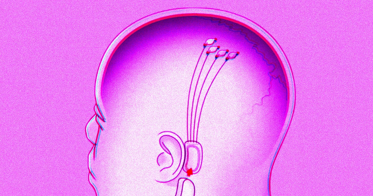 Tesla CEO Elon Musk has said that Neuralink, a neurotechnology company that he co-founded, plans to put brain chips in humans next year. 