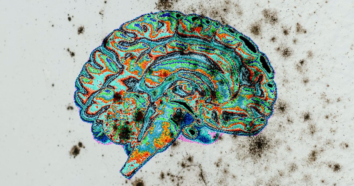 This Rhode Island man's story of his terrifying and rare brain mold condition reminds us that disease truly is everywhere.