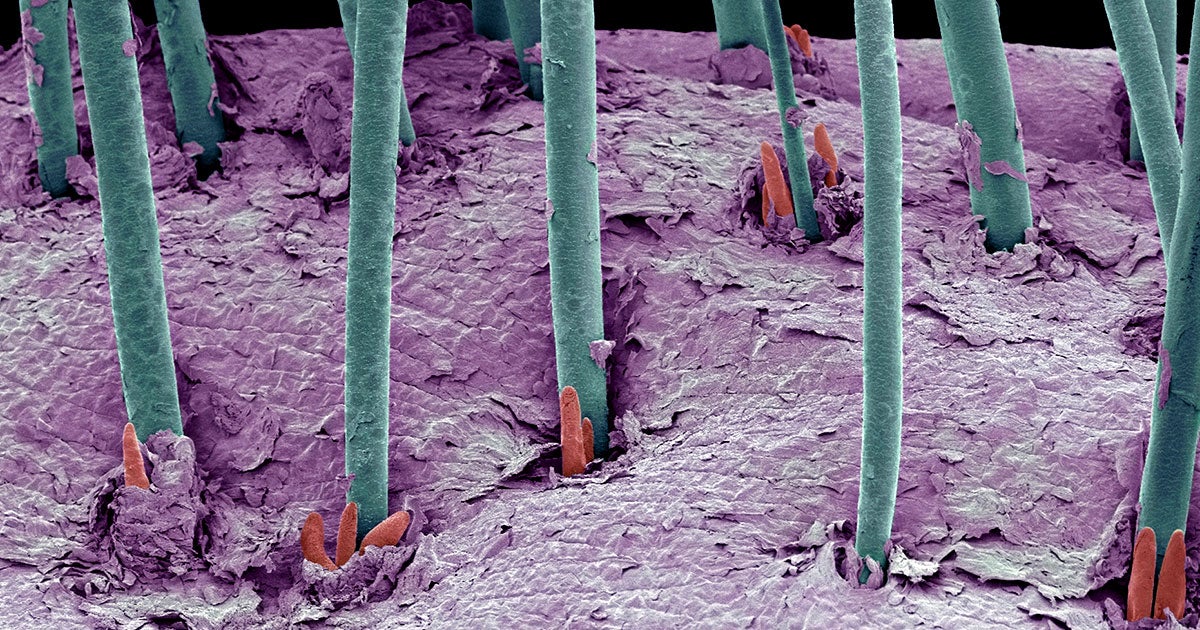 Ernesto Lujan, a biologist and founder of medical startup dNovo, says his company has successfully transplanted human hair stem cells onto a mouse.