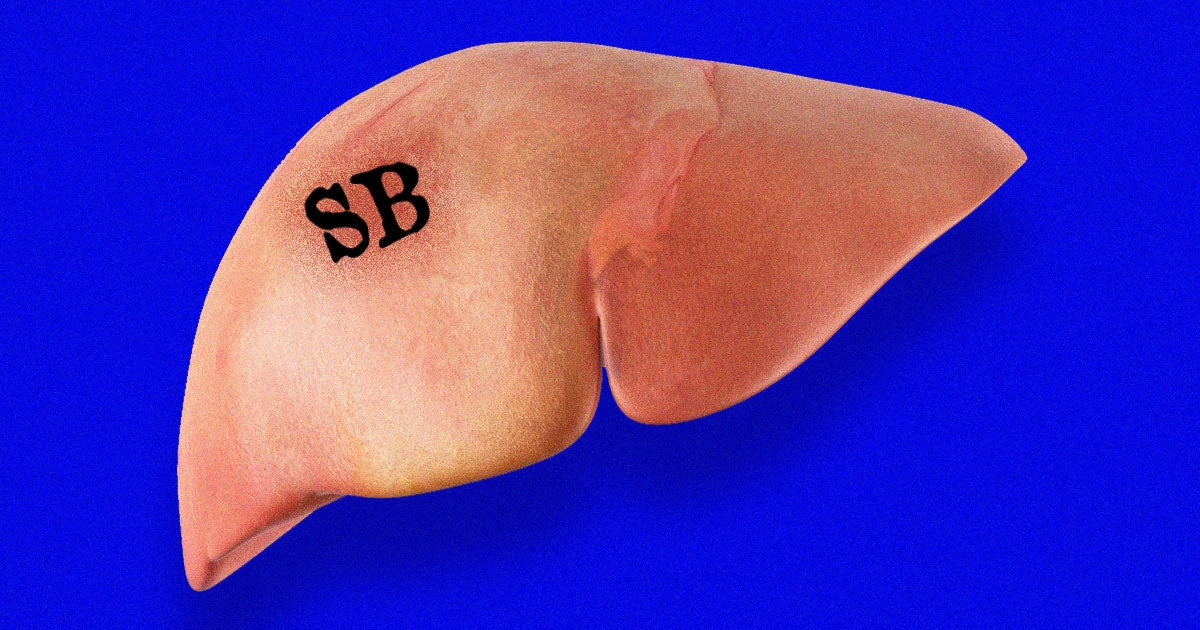 A British transplant surgeon has finally been stripped of his medical license after infamously branding his initials into patients' organs in late 2013. 