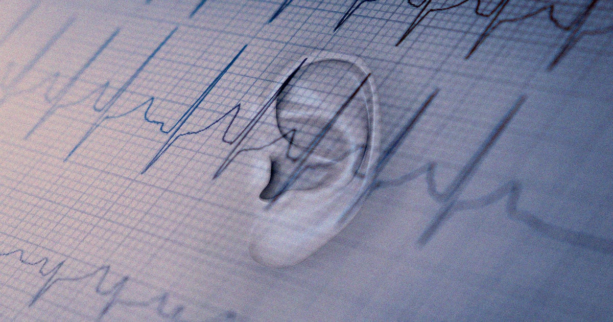 A startup called NextSense is working on a pair of earbuds that can record the electrical signals of the brain to study sleeping and mental conditions.