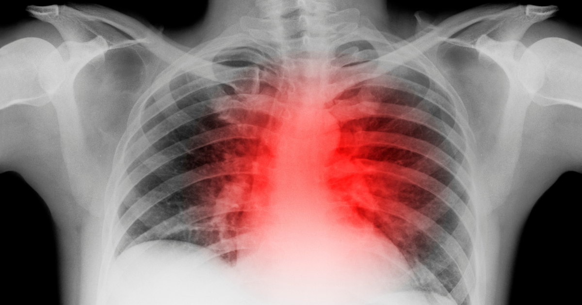 Verve Therapeutics, backed by Google Ventures, says Crispr gene editing to reduce humans' bad cholesterol, reducing heart attacks.