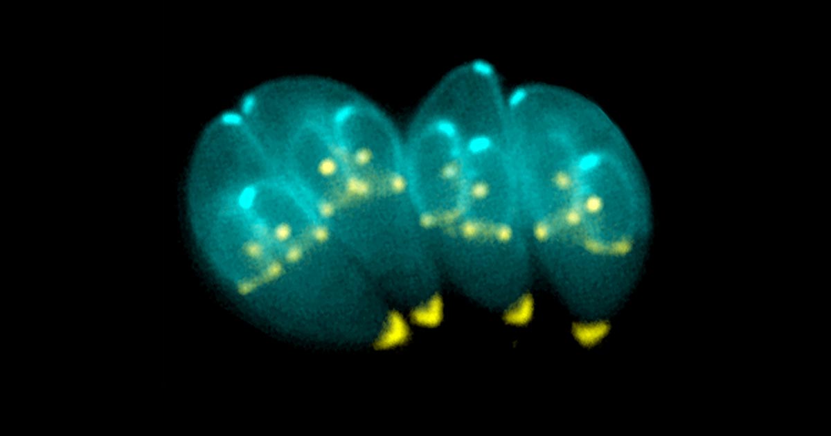 Scientists have found a new avenue for finding out whether someone's been exposed to the world's preeminent parasite — by looking at their eyeballs. 
