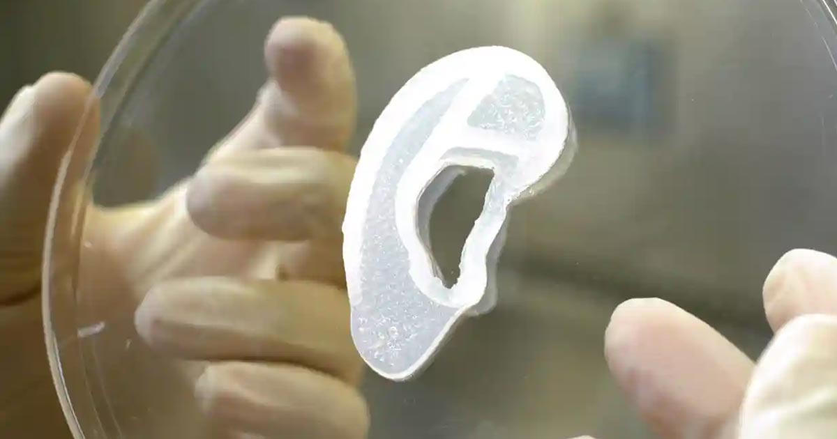A team of scientists at the regenerative medicine company 3DBio Therapeutics have successfully implanted a 3D printed ear made from the patient's own cells.