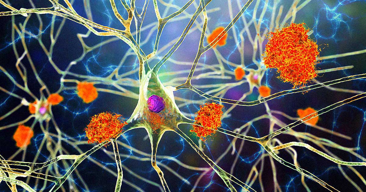 Researchers have found that getting at least one flu shot makes it 40 percent less likely for people over the age of 65 to be diagnosed with Alzheimer's.