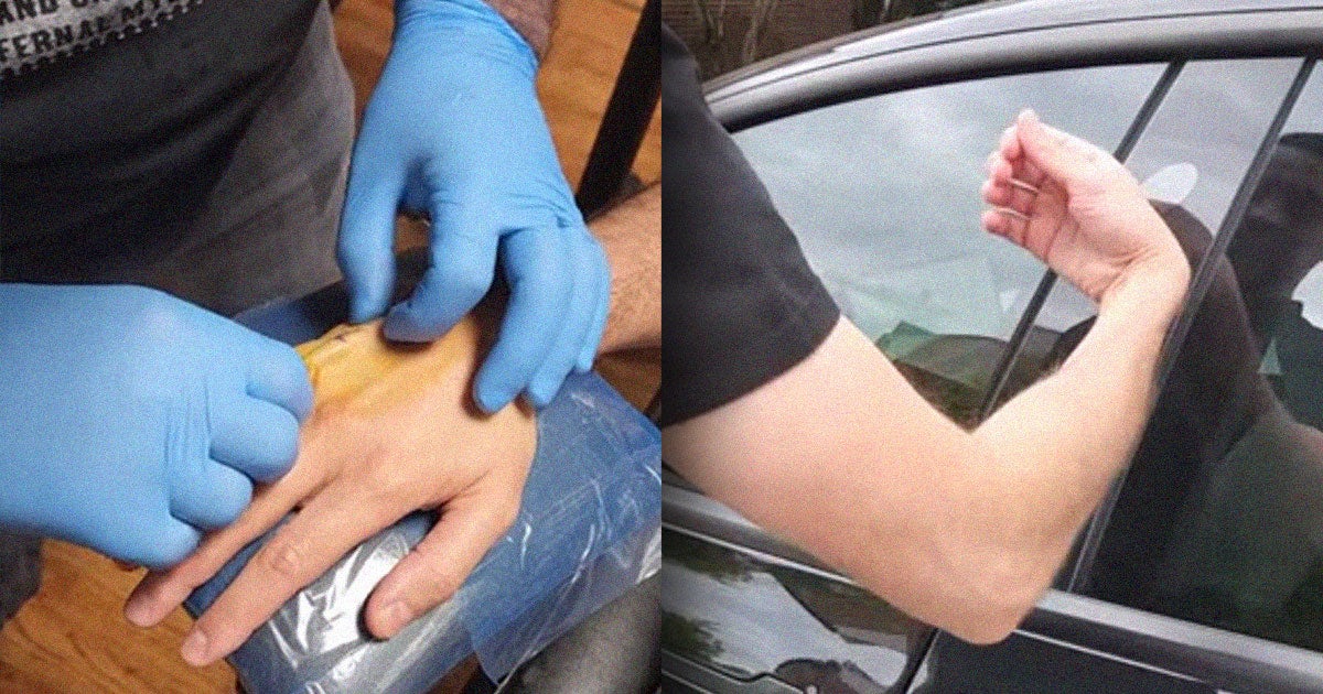 Tesla owner Brandon Dalaly now has a contactless, car-unlocking microchip, outfitted with a Tesla-linked app, installed in the back of his right hand.