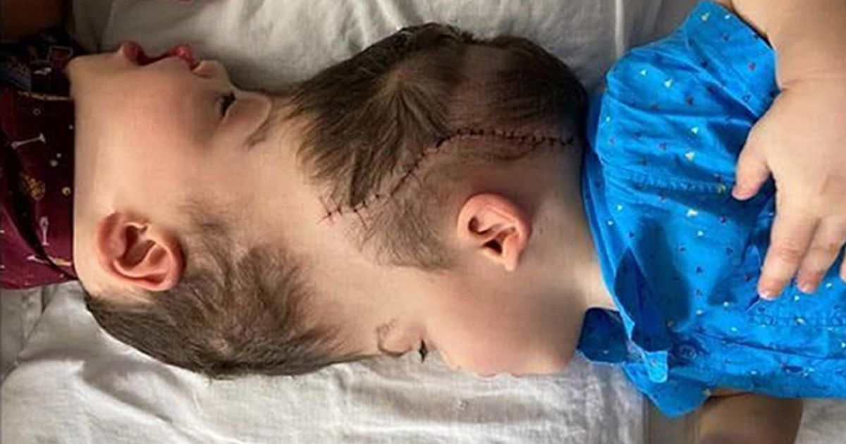 Miraculously, surgeons just successfully completed one of the most complicated conjoined twin separations ever recorded — with the help of virtual reality.