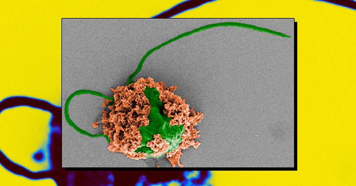 Nanoengineers at the UC Davis have officially developed microbots that can swim around a mouse's lungs and deliver pneumonia-clearing medicine.