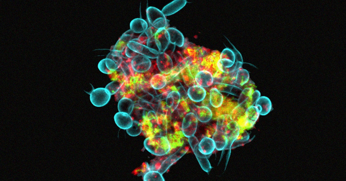 Researchers have discovered that bacteria and fungi can join forces to form assemblages of "superorganisms" that can "walk" across your teeth.