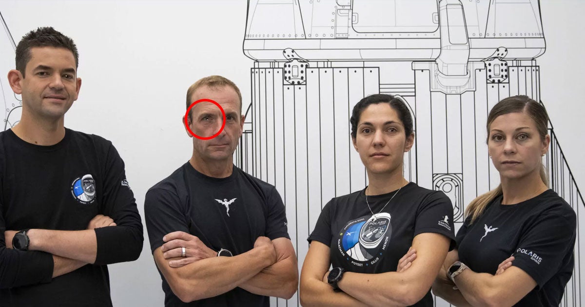 Onlookers have been puzzled by the weird look in the eyes of the astronauts selected for SpaceX's Polaris Dawn mission, and there's a cool reason why.