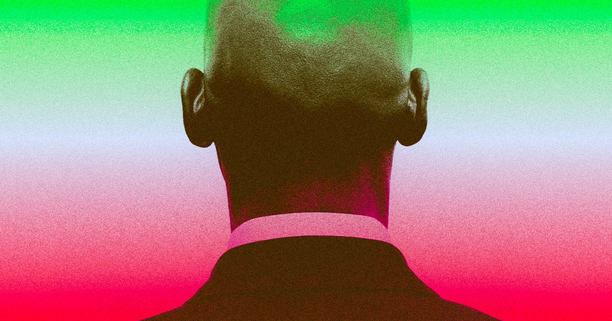 Soda and energy drink drinkers, beware — it looks like your favorite sugary drinks may be linked to male pattern hair loss.