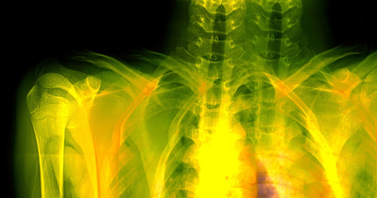 In a spine-tingling bit of fictional horror, a pair of X-ray technicians discover that their patient has no skeleton — and secrets even scarier, too.