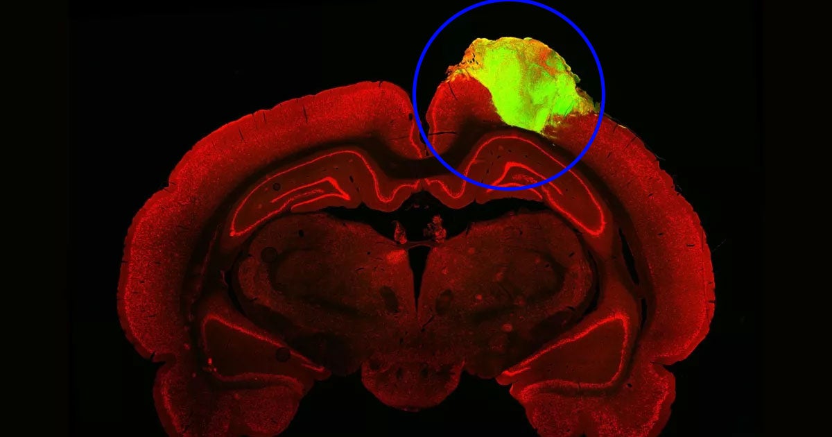 A team of researchers at the University of Pennsylvania has inserted human neurons into the brains of rats with damaged visual cortices.