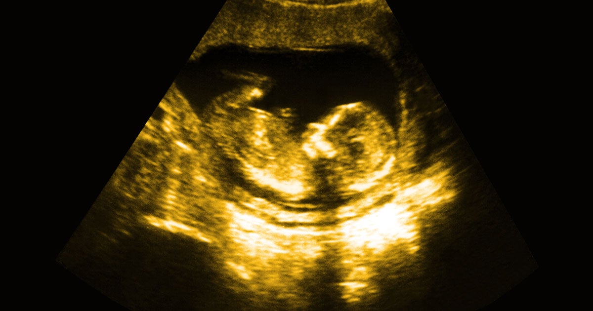 The lawyer of a 24-year-old woman, who is eight months pregnant and currently in jail, is alleging that his client's fetus is being illegally detained.