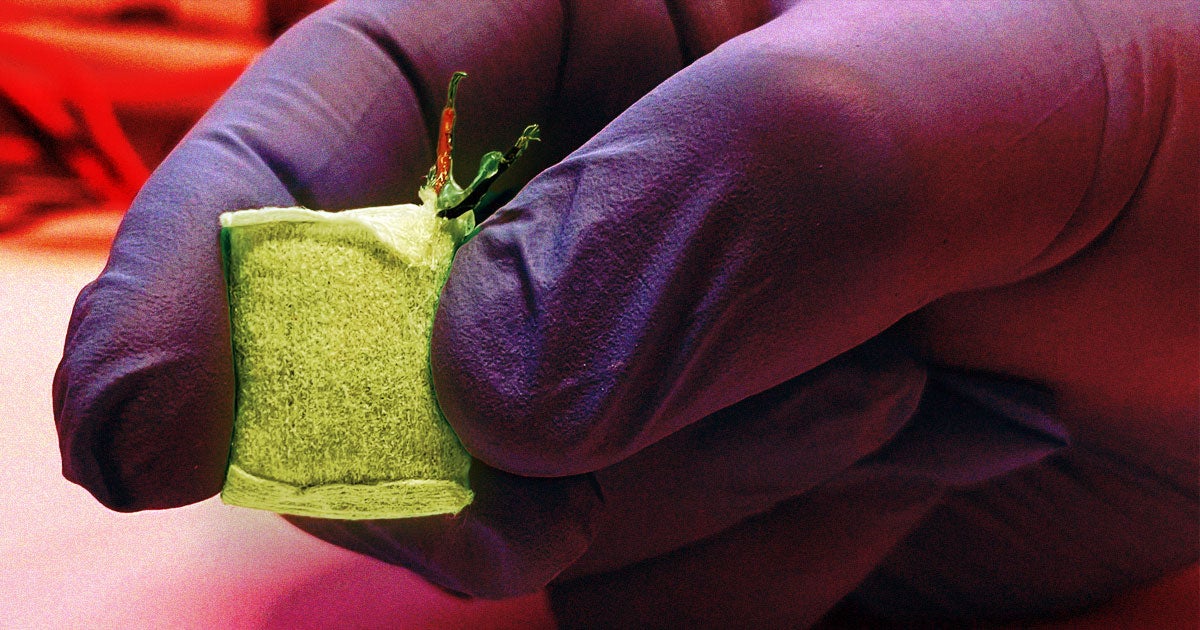 A team of researchers has come up with an implantable fuel cell that can manage type 1 diabetes — and make use of glucose in the body to power itself instead of relying on an external power source.