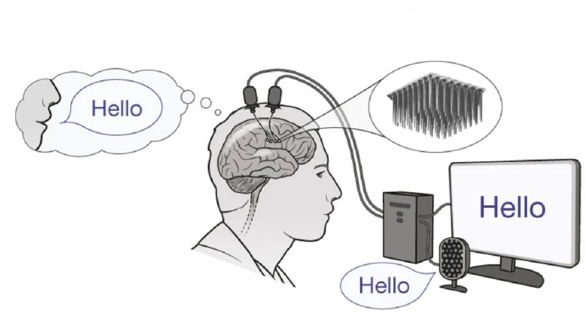 The device not only converts brain signals into text, but transforms it into full-blown speech embodied in a digtal look-a-like.