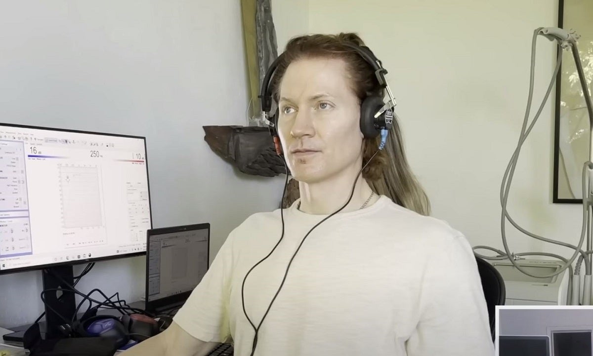 We regret to inform you that biohacking tech millionaire Bryan Johnson is back at it again, with a new body part.