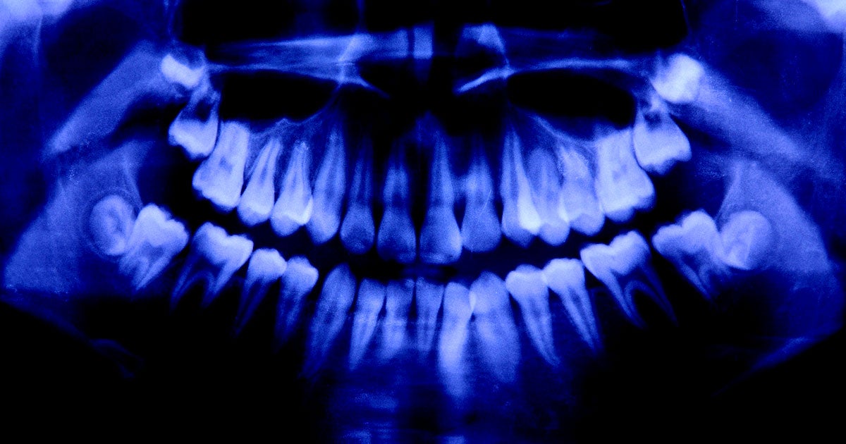 A team of researchers has taken an important step toward a future where we can regenerate human teeth with the use of stem cells.