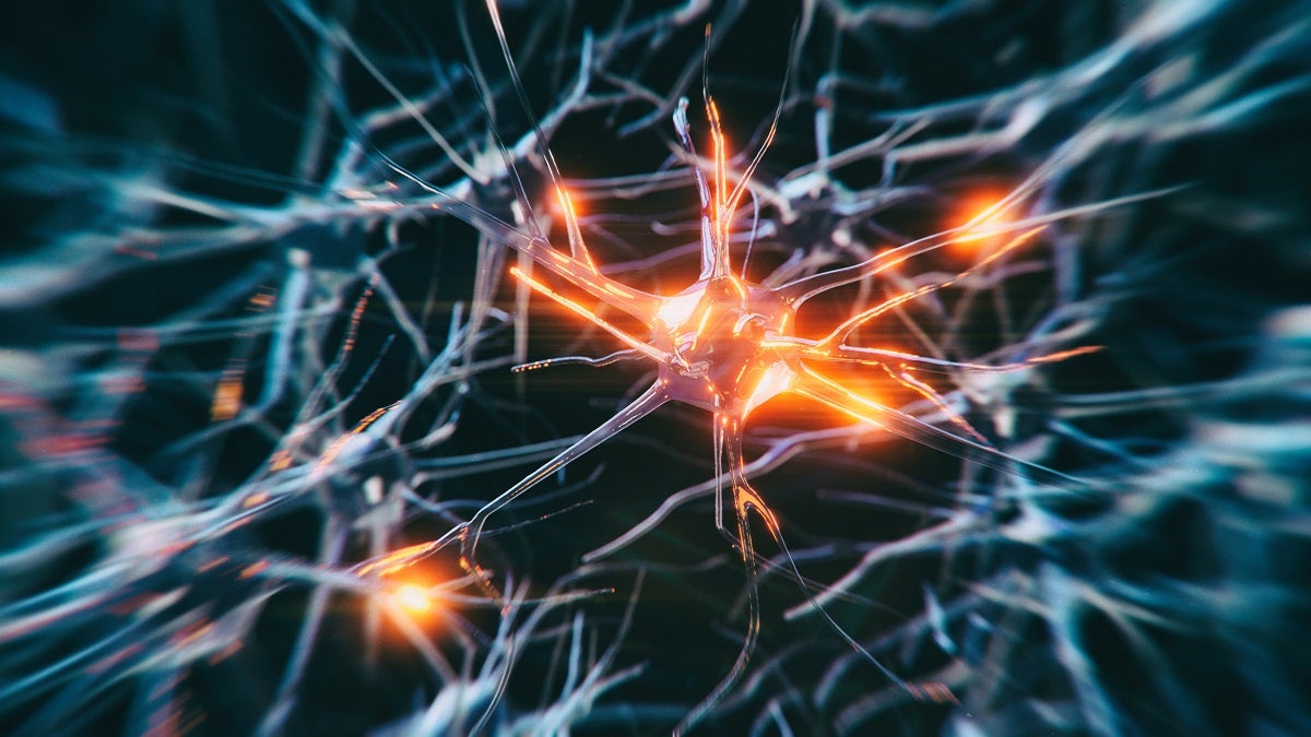 A California-based biotech company says it has successfully implanted lab-made neurons in Parkinson's patients' brains to stimulate dopamine.