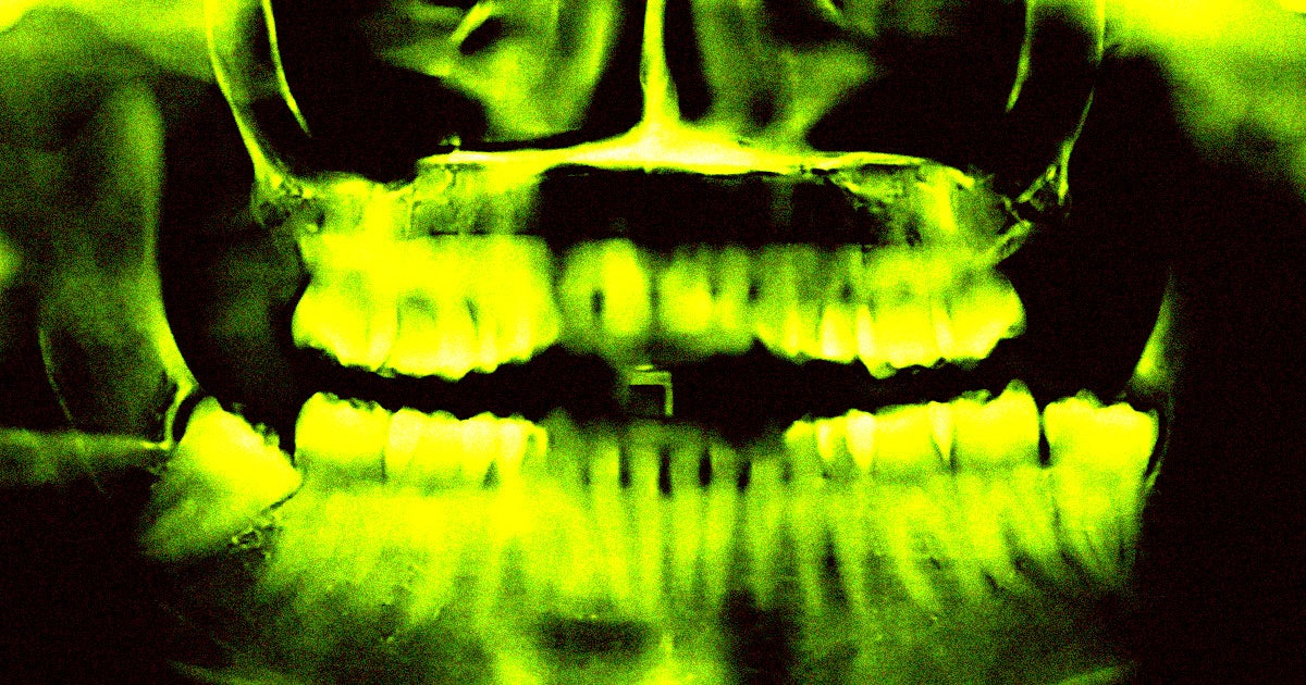 A Japanese company says it has developed a new antibody drug that stops proteins in the mouth responsible for suppressing tooth growth.