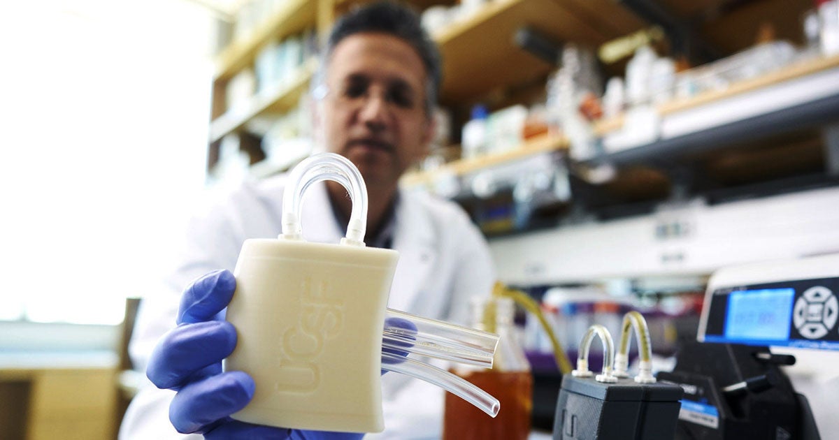 Scientists have developed a bioreactor that can survive inside a pig that is designed to mimic some of the vital functions of a kidney.
