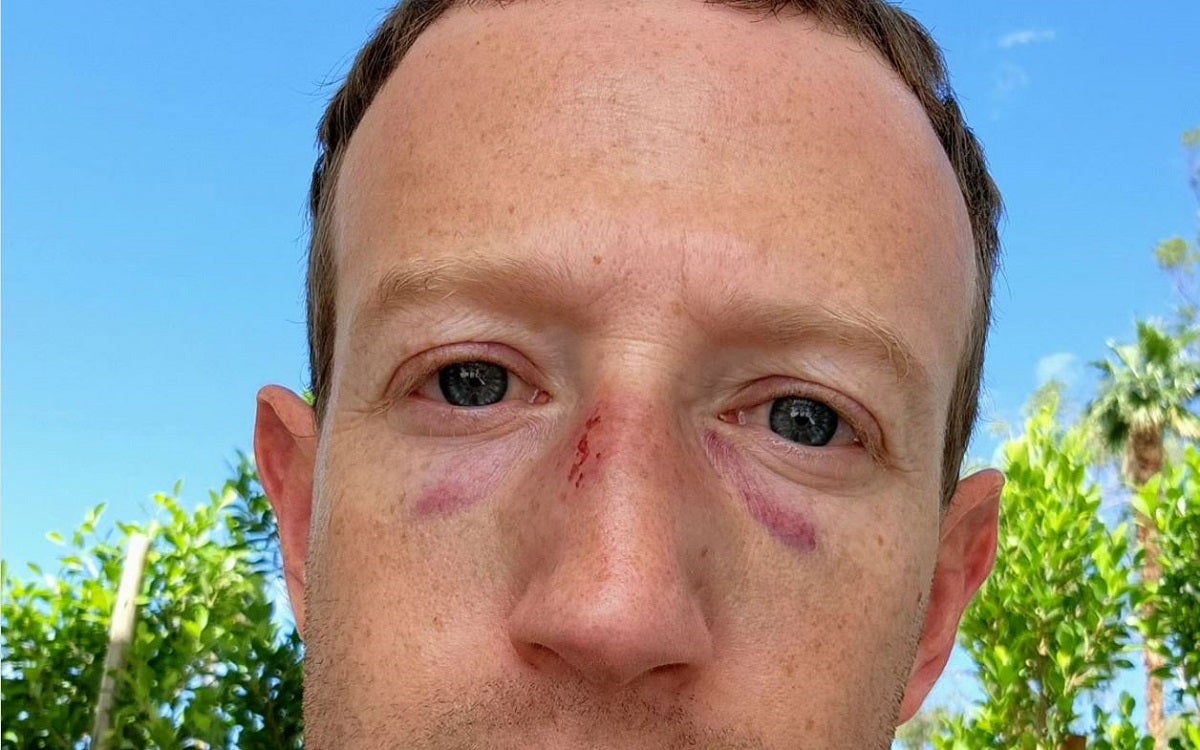Meta-formerly-Facebook CEO Mark Zuckerberg, an avid jiu-jitsu devotee, took to Instagram to show off recent training trophies: two black eyes.