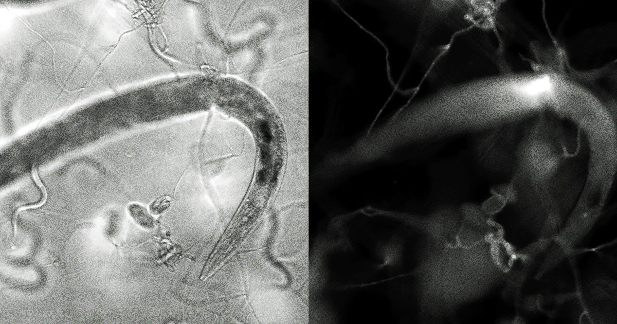 This so-called nematode trapping fungus is a crafty, efficient killer that will quickly switch from prey to predator once it senses a worm.