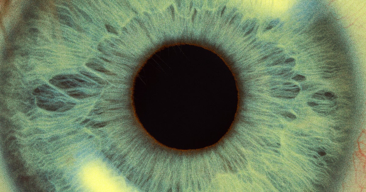 In a first-of-its-kind, doctors said they had transplanted an entire eyeball into an Arkansas man who had suffered a high-voltage accident.