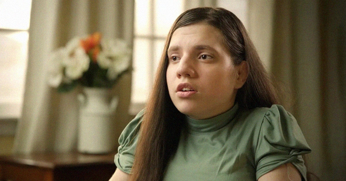 A DNA test has confirmed the biological age of Natalia Grace, a Ukrainian orphan who has a rare genetic dwarfism condition.