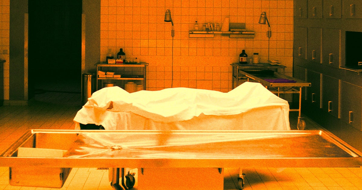 Patients who received the cadaver hormones when they were children in a banned medical practice show signs of Alzheimer's decades later.