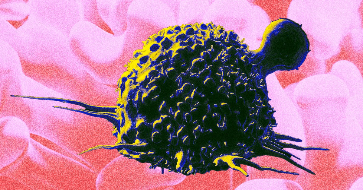 Young people are getting diagnosed with cancer at rates higher than ever before — and doctors are stumped as to why.