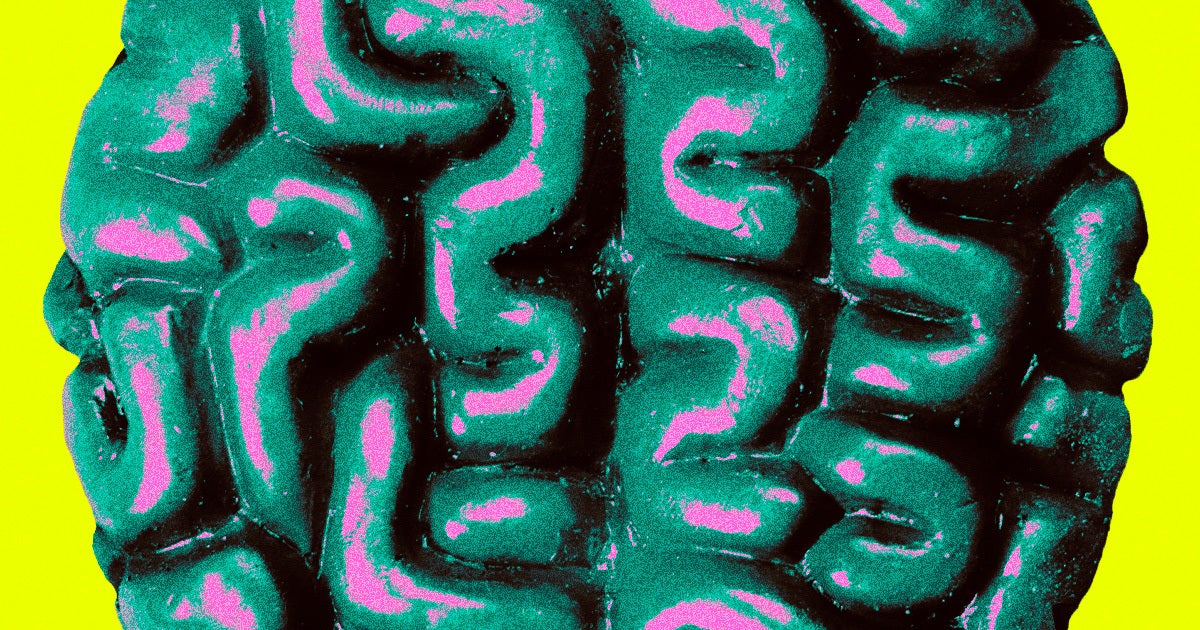 People’s brains have gotten bigger compared to those born in the 1930s, according to research, and that bigger brains may stave off dementia.