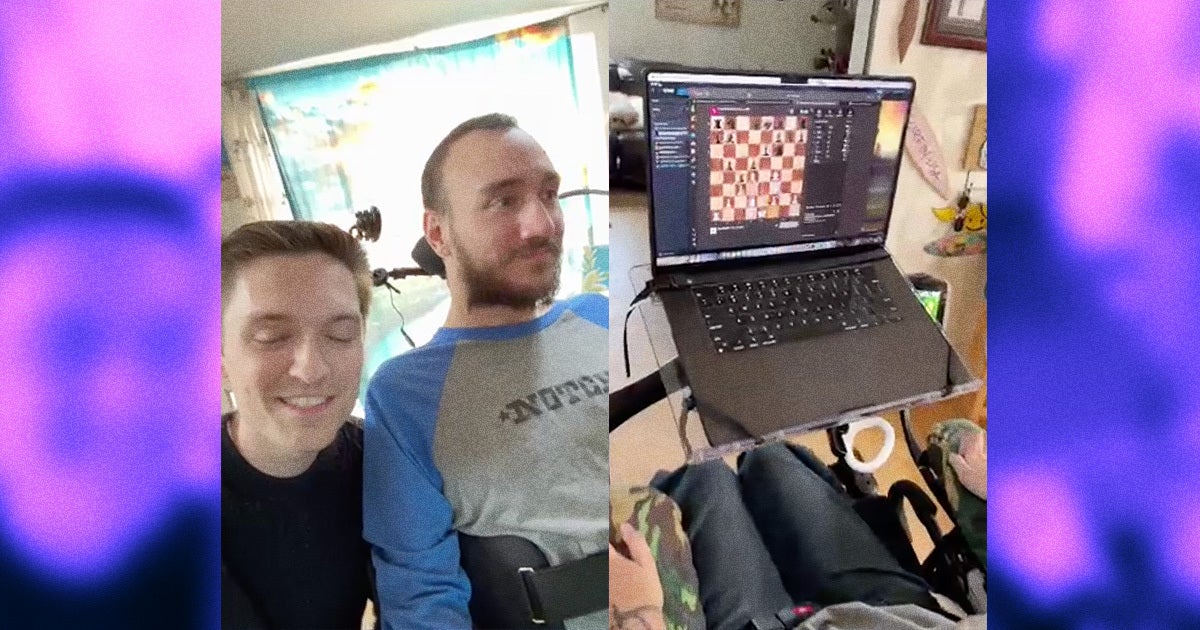 A livestream by Neuralink on Wednesday introduces the public for the first time to the first human recipient of its brain implant.