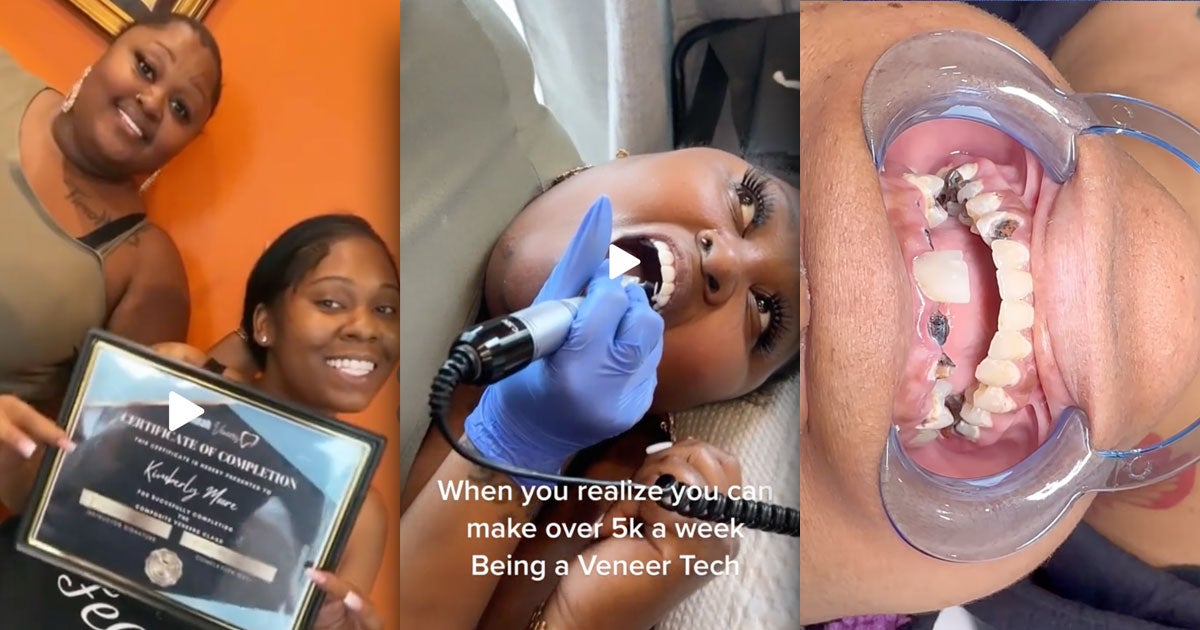 A grisly new trend is emerging on TikTok, with self-proclaimed "veneer technicians" performing illegal dental surgery.