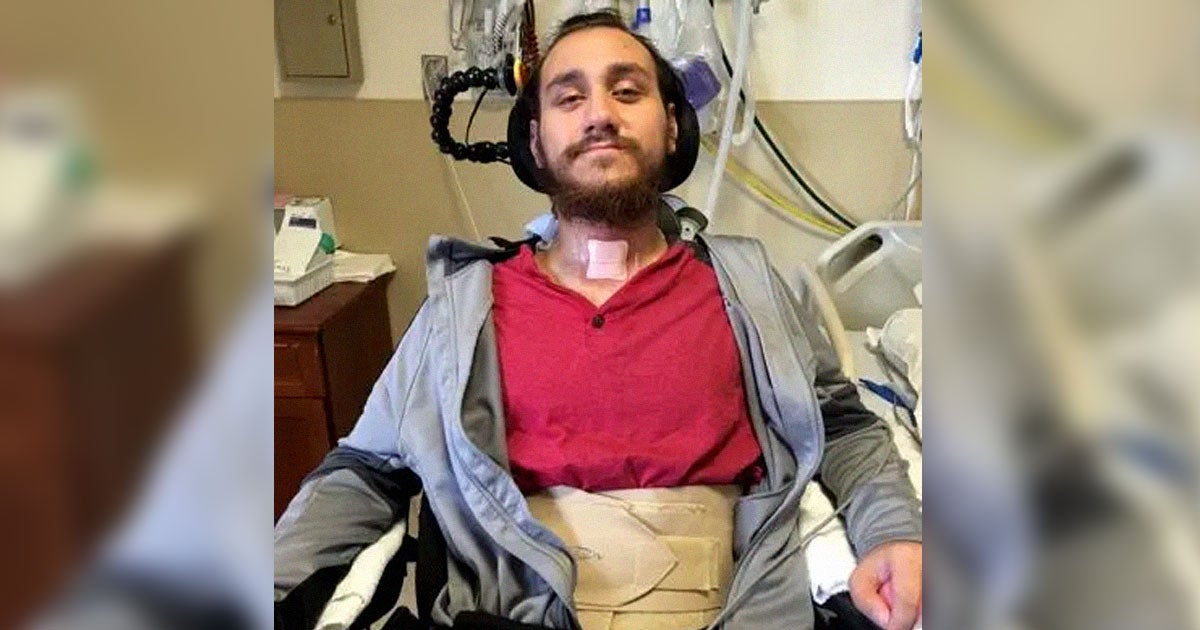 In a new Bloomberg interview, Neuralink's first human patient recalled the time the brain-computer chip started glitching.