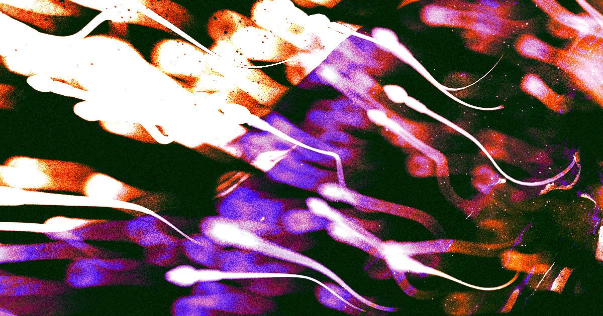 In clinical trials, a new male birth control gel seems to adequately reduce sperm count without decreasing libido.