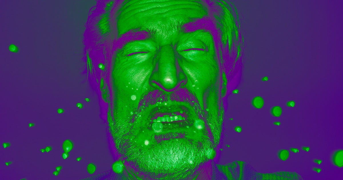 A man in Florida had such an epic sneeze that he pushed his guts outside his body after he had surgery 15 days ago.