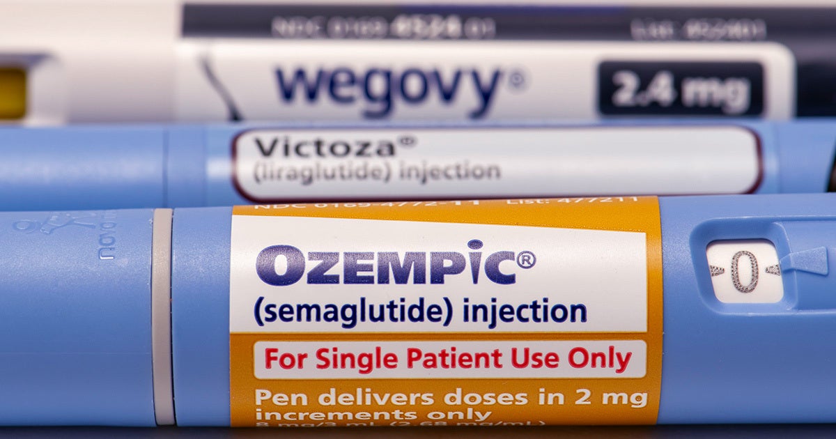 A woman prescribed Ozempic and Wegovy is now suing the company that makes it after losing her colon from complications caused by the drugs. 
