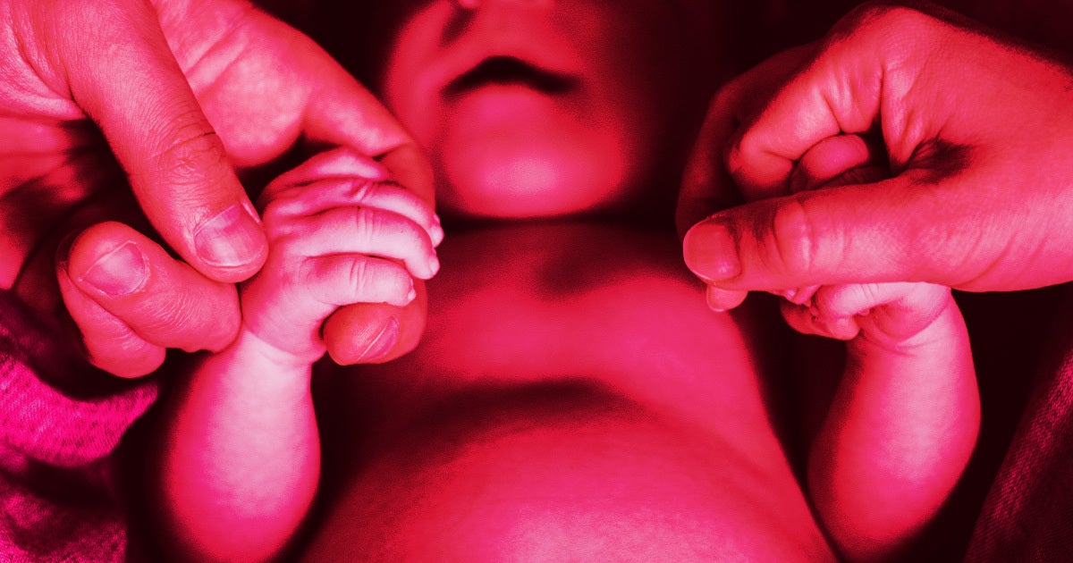 New research shows that in post-Roe America, more babies are dying within their first year of life, largely because of fatal abnormalities.